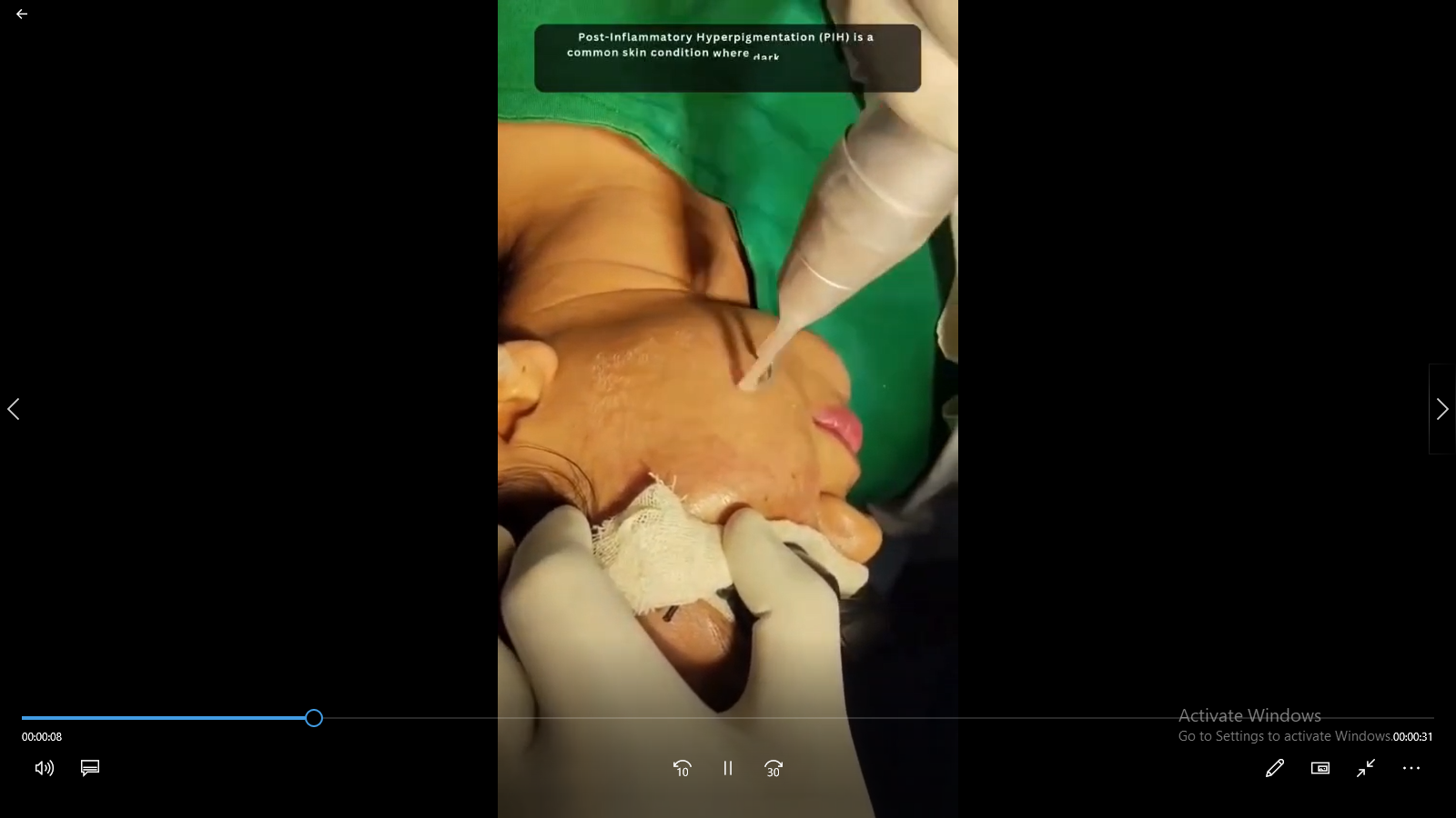 PRP Therapy